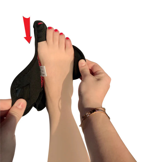 Støttebandasje for Hallux Valgus | Avtakbart metallbånd